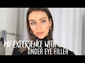 Under Eye Filler Injections | My experience + before and after