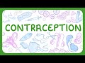 Contraception Methods Quiz