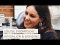 Louise thompson  teeth transformation with invisalign and composite bonding