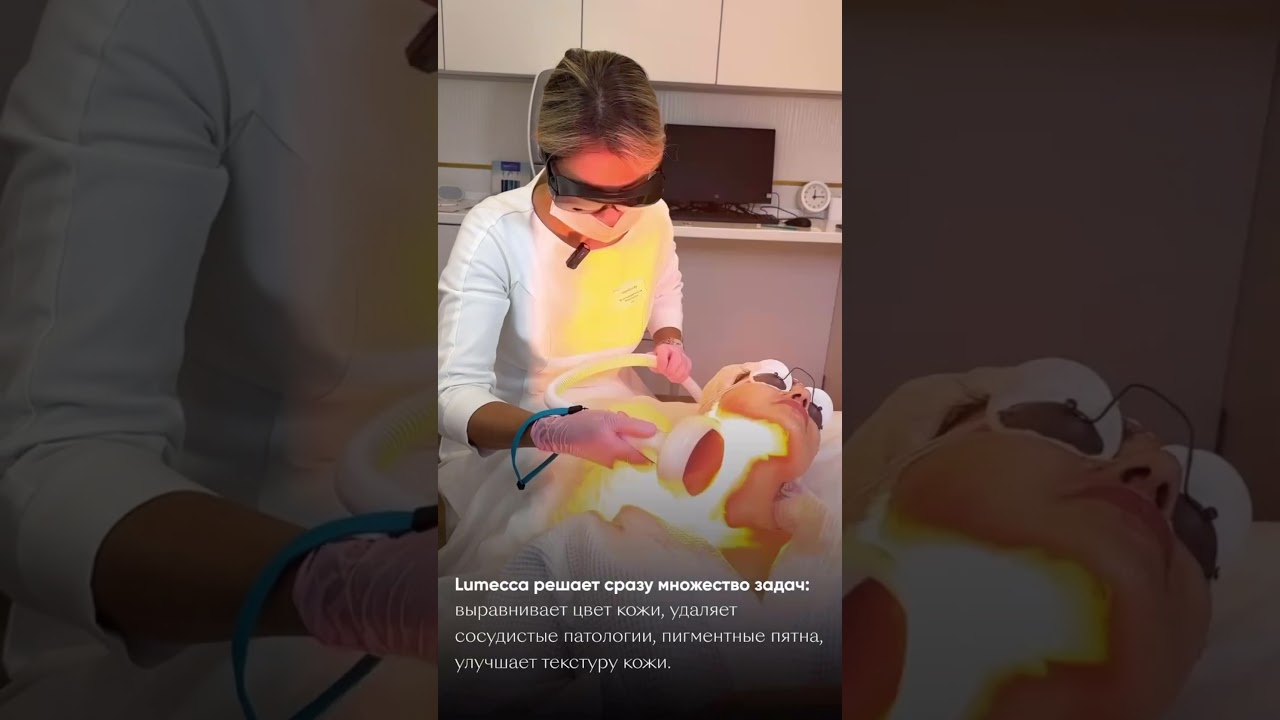 Фотоомоложение Lumecca #фотоомоложение #купероз #розацеа #удаление пигментных пятен #косметолог