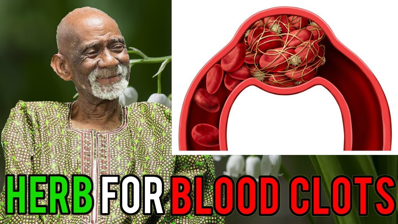 natural numbers Dr Sebi Reveals Herb For Blood Clots