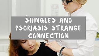 Shingles and Psoriasis: Strange Connection