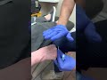 How to start an IV on a live human!