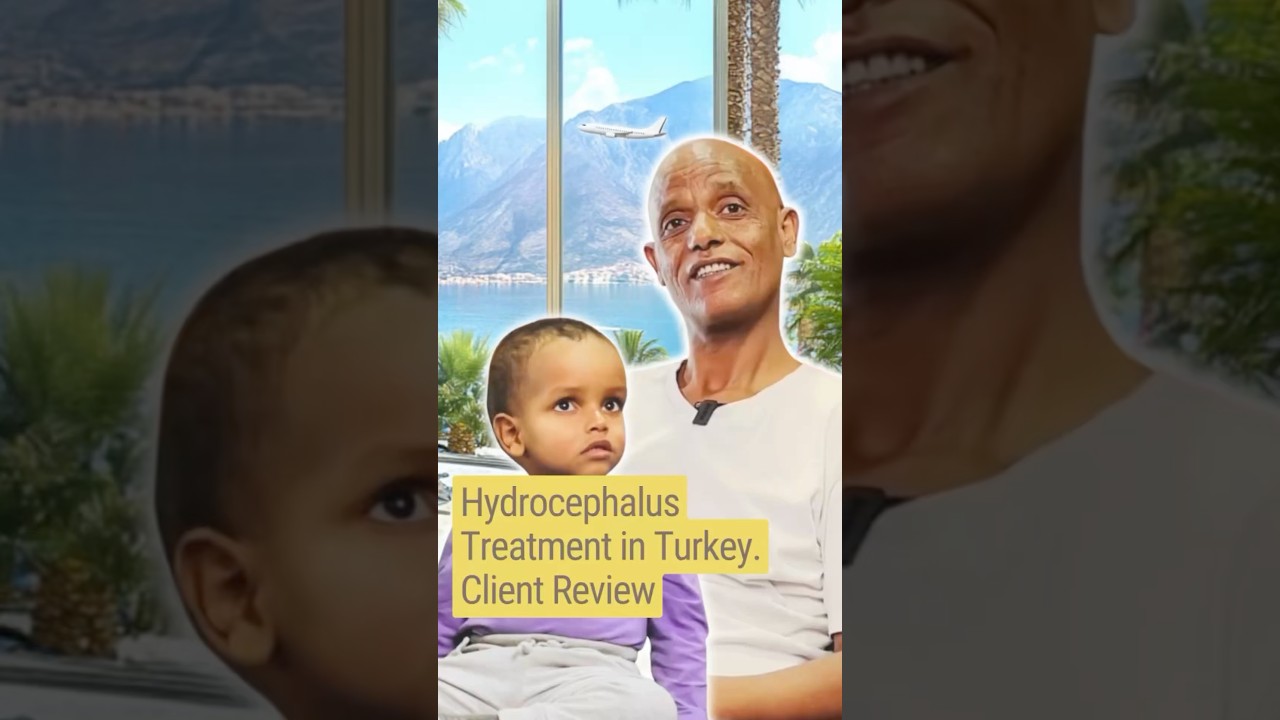 Hydrocephalus Treatment in Turkey. Amazing Review by Teklu Tesfay 