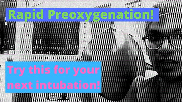 My Rapid Preoxygenation Technique