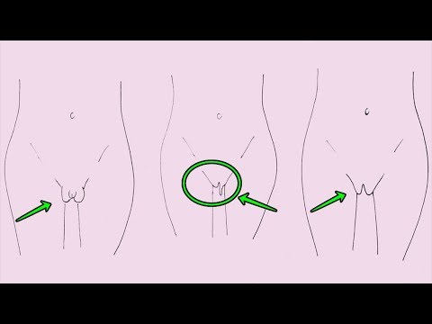 Is my vagina normal shape size vulva labia   These are the 7 different types of labia