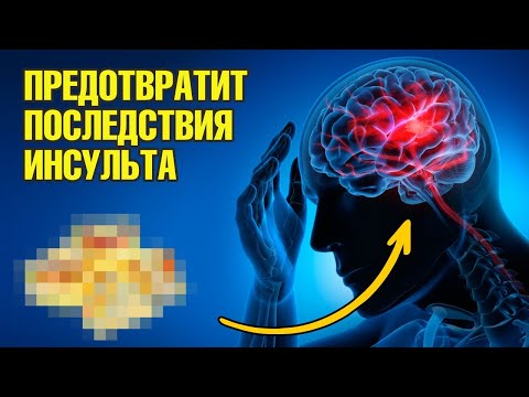 Восстановление после инсульта. Это точно поможет👍