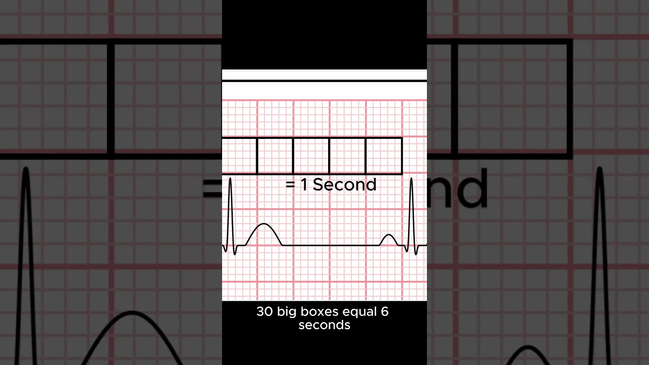📊 EKG Grid SPEED Guide! ⏳ 