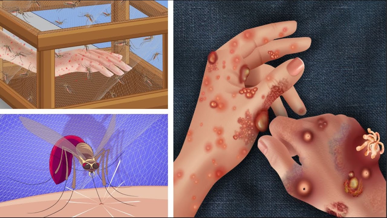 ASMR The best treatment vs removal of insect bites, blisters on the hands of scientists 돌보는