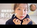 【敏感肌OK】肌トーンが本当に上がった。低刺激美白アイテム!赤み×ニキビ跡