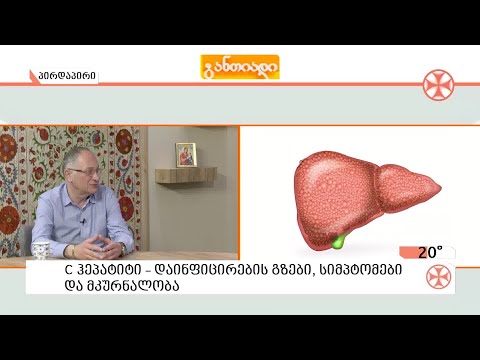C ჰეპატიტით ინფიცირების გზები, სიმპტომები და მკურნალობა -  ინფექციონისტი კახაბერ ჩომახიძე