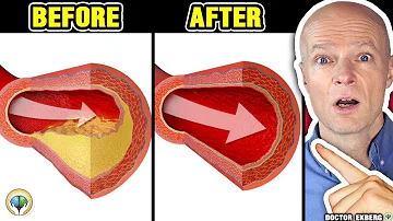 Only A Glass Of This Juice... Reverse Clogged Arteries & Lower High Blood Pressure - Doctor Reacts