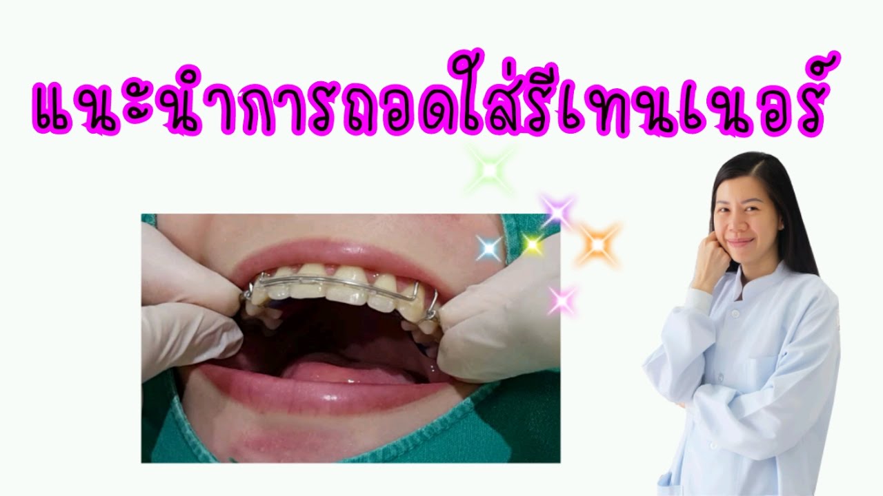 แนะนำการถอดใส่รีเทนเนอร์