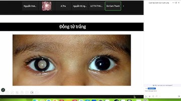 Ung thư ở trẻ em - Bạch cầu cấp ở trẻ em