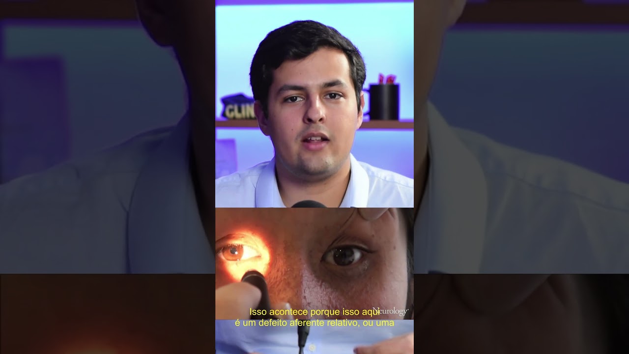 Thumbnail - Sabe que pupila é essa?