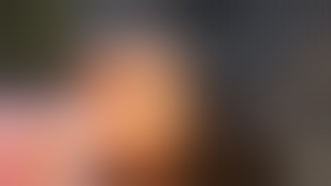 Routine Flip-and-Chop Cataract Surgery