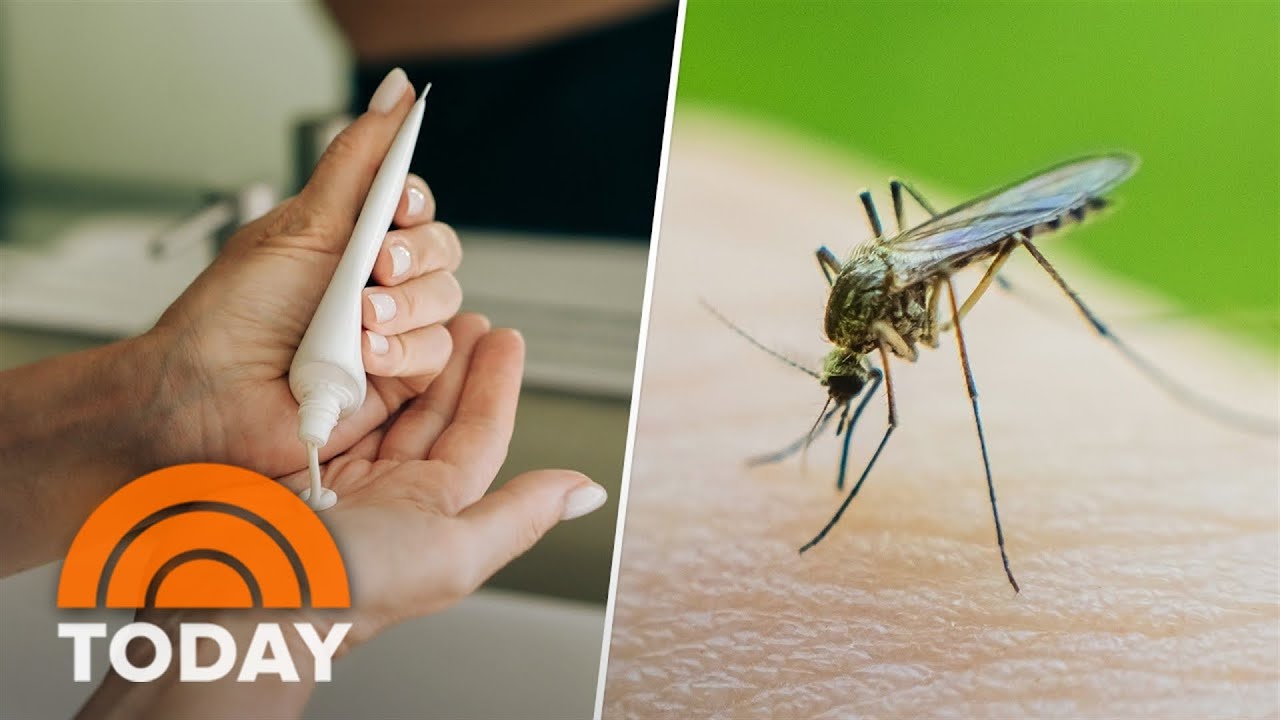 How to avoid bug bites, sunburns and heat stroke this summer - YouTube