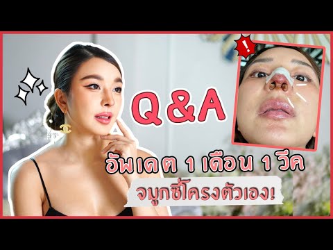 Q&A ตอบทุกคำถาม! อัพเดตจมูกซี่โครงตัวเอง 1 เดือน | Yae uunws