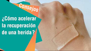 ¿Cómo puedo acelerar la recuperación de una inflamación?