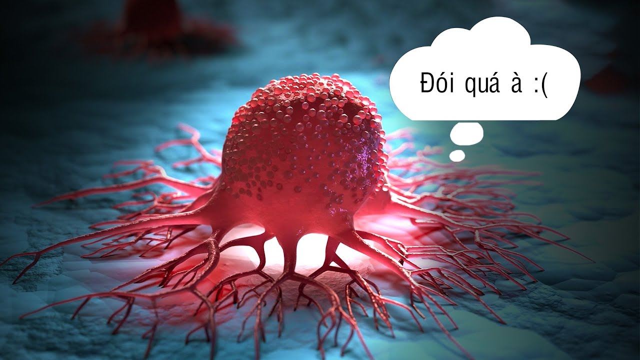 Cẩn Trọng Với Phương Pháp "Bỏ Đói Tế Bào Ung Thư"!