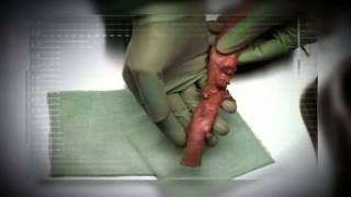 India - Artery Cigarette Malayalam