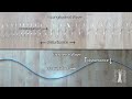 Waves Unleashed: Understanding Mechanical Waves and Their Properties