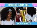 2 SIMPLE WAYS TO USE ONIONS FOR FASTER, LONGER,THICKER HAIR GROWTH.