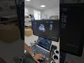 Color Doppler US-HCL 3 Laptop type, 3D/4D mode15-inch medical HD display button image optimization