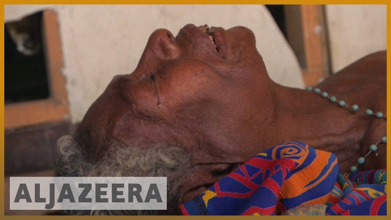 🇵🇬 أزمة صحية: بابوا غينيا الجديدة تكافح خطر السل | الجزيرة الإنجليزية