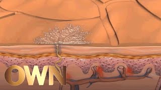 How to Deal With Excessive Sweating | Ask Oprah's All Stars | Oprah Winfrey Network