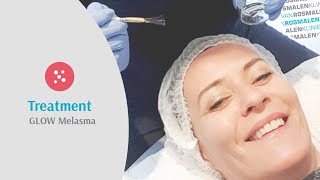 Treatment Confidence Booster Glow Melasma - Voor Een Egale Huid Zonder Verkleuringen