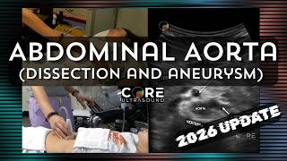 Abdominal Aorta (Dissection and Aneurysm) 2026 Update!