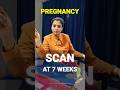Scan At 7 Weeks Of Pregnancy #fetalmovement #pregnancy #medicaladvice #shorts