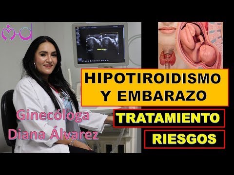 HIPOTIROIDISMO Y EMBARAZO, POR GINECOLOGA DIANA ALVAREZ