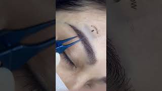 eyebrowplantingworkshop #eyebrowplantingvideo #植眼睫毛課程 #植眉毛教學 #植睫毛 #植发疤痕 #植眉植发植眼睫毛植胡子 #植发 #植发效果