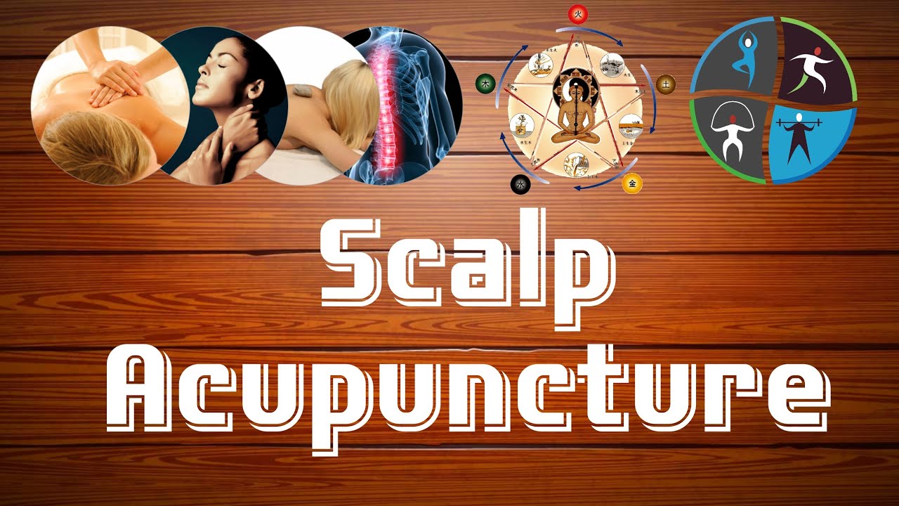 Scalp Acupuncture for Stroke Rehabilitation #stroke #rehabilitation # ...