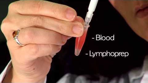 Comet Assay Stage 1: Isolating Lymphocytes - Mini Prep