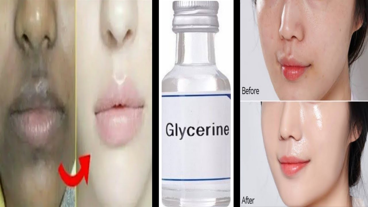 रात को glycerine इस तरह लगा लें, सुबह तक चेहरे पर ऐसा गोरापन आएगा कि