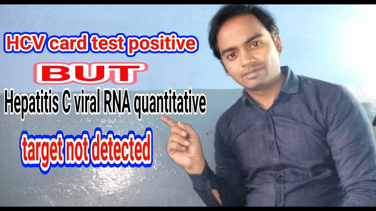 HCV card test is positive but Hepatitis C viral RNA quantitative टारगेट not detected. doubt clear.