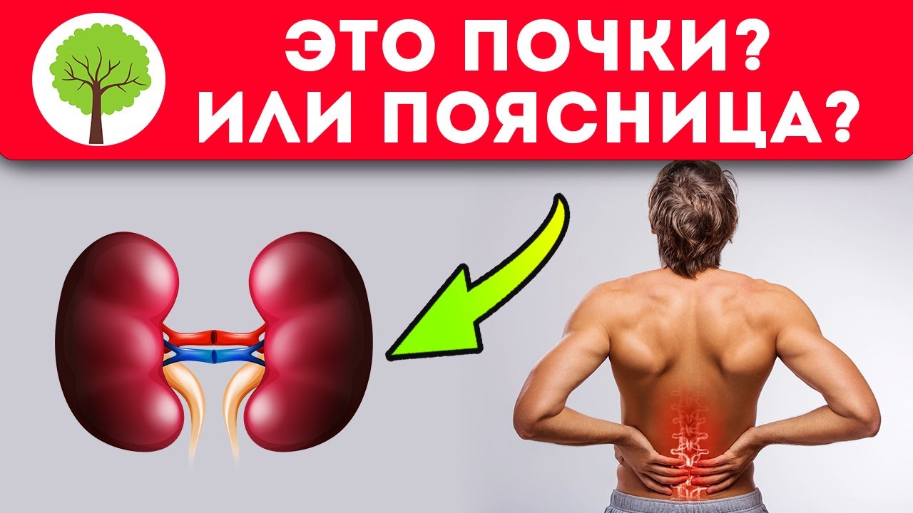Теперь точно различаю! Как отличить почечную боль от поясничной? - YouTube