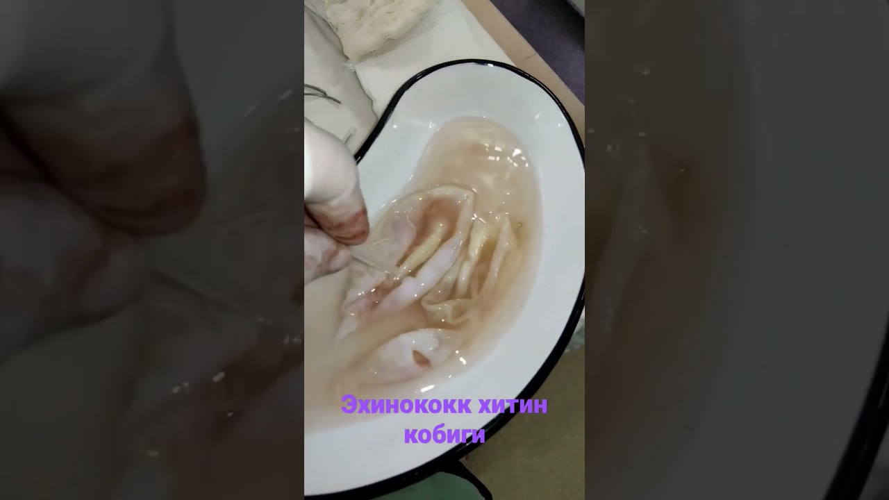 Эхинококк хитин кобиги