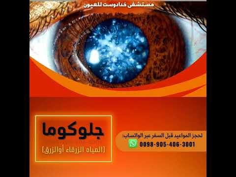 الجلوكوما الغلوكوما المياه الزرقاء الزرق الماء الاسود في العين  مستشفى خدادوست للعيون