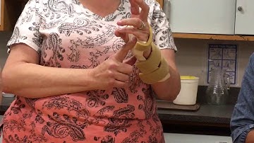 Different types of splints 1st video