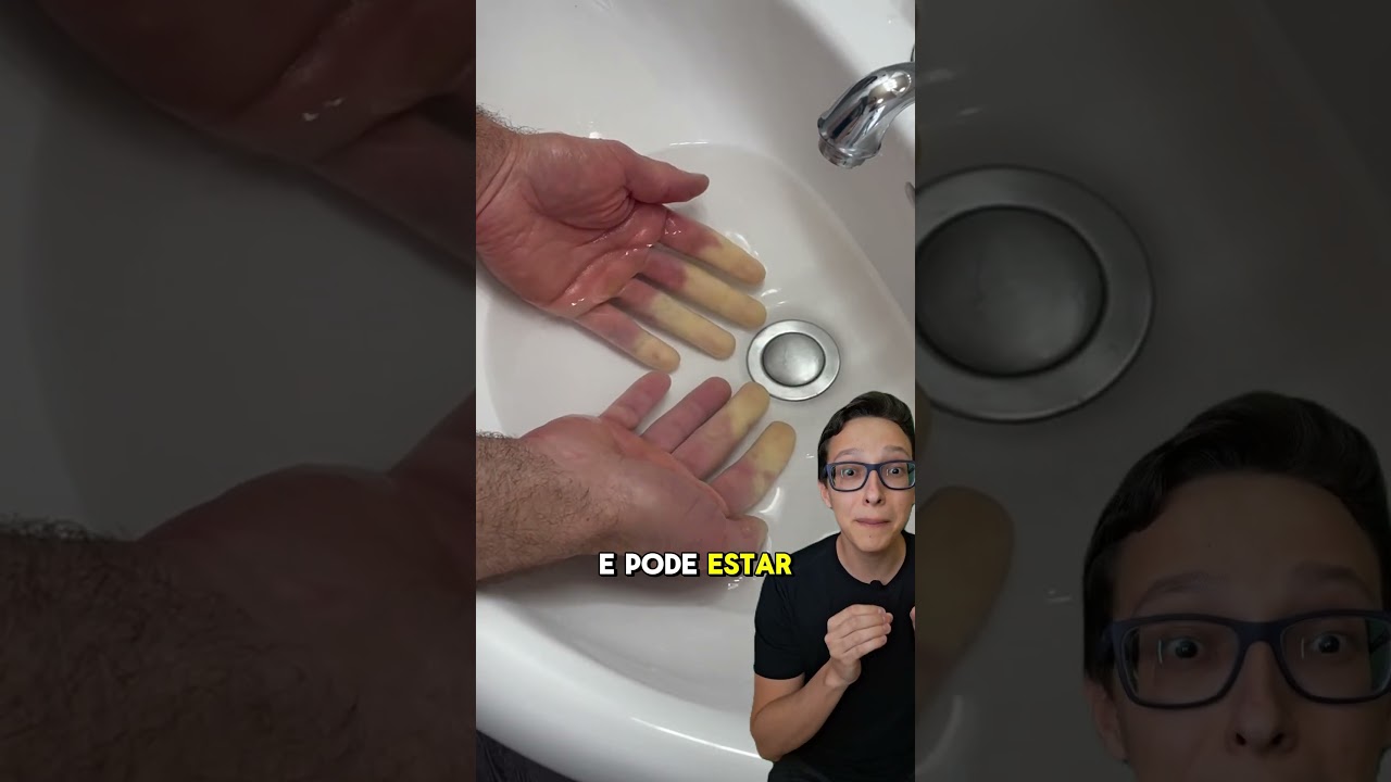 Fenômeno de Raynaud 😱