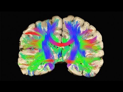 Wideo: Czy kaski zapobiegają wstrząsom mózgu?