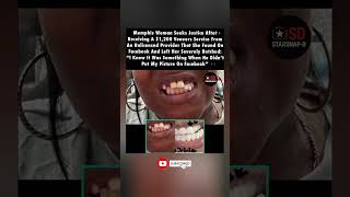 Botched by a Facebook “Dentist” – She Paid the Price #BotchedVeneers #shorts
