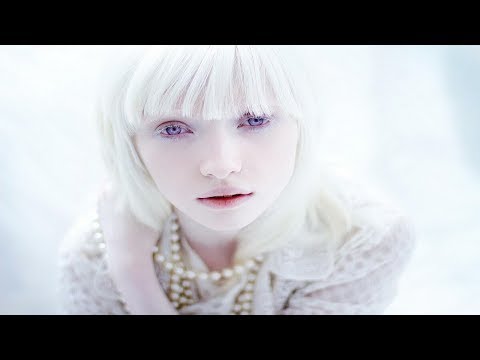 АЛЬБИНОСЫ. Необычные люди. Истории из жизни