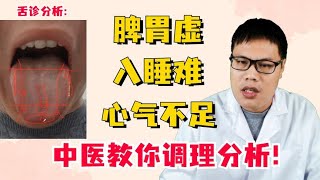 脾虚百病生 ，脾胃虚 入睡难、心气不足怎么办？中医教你调理分析
