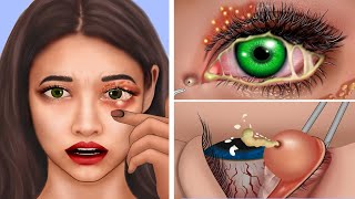 ASMR Causes and The best treatment eyes, swollen eyes, beautify healthy eyes - ASMR 치료