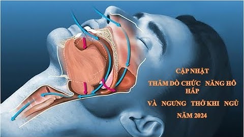 Cập nhật thăm dò chức năng hô hấp và ngưng thở khi ngủ năm 2024